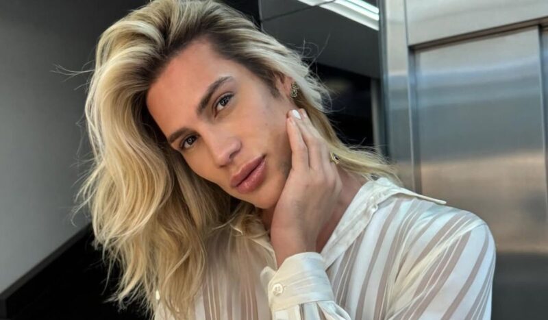 Muere el influencer Junior Dutra tras someterse a cirugía “foxy eyes”