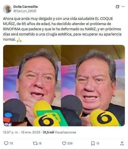 Coque Muñiz considera cirugía estética para corregir deformación en su rostro: «Quiero recuperar mi apariencia normal»