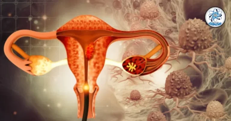Avance médico revolucionario: Científicos desarrollan prueba que detecta endometriosis en cuestión de horas