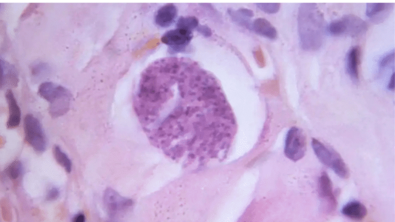 Un parásito cerebral más activo de lo que creíamos: lo que revela la ciencia