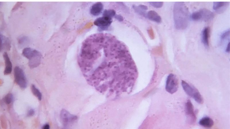 Un parásito cerebral más activo de lo que creíamos: lo que revela la ciencia