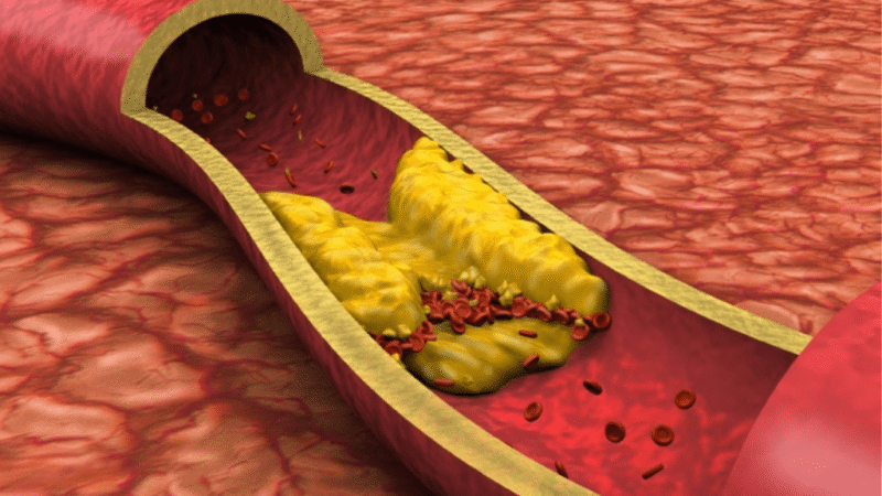 Una dieta de avena de 48 horas podría reducir el colesterol durante semanas
