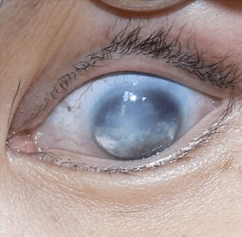 Un virus marino podría haber saltado a humanos por primera vez