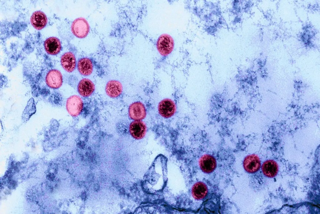 Un virus marino podría haber saltado a humanos por primera vez 2 virus - virus