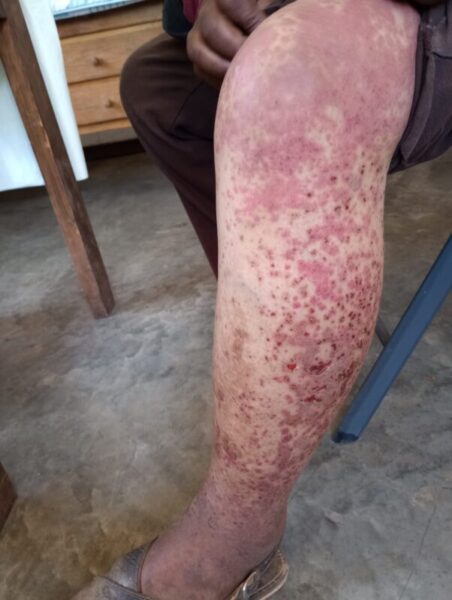 Advierte Contec falta de médico y medicamentos en Baborigame