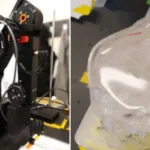 Pequeños robots podrían disolver cálculos renales en solo días sin necesidad de cirugía