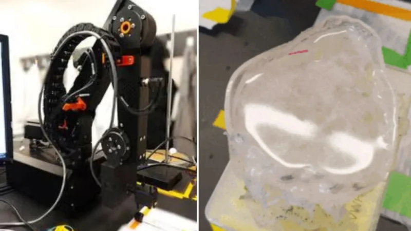 Pequeños robots podrían disolver cálculos renales en solo días sin necesidad de cirugía