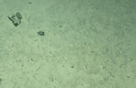 Descubren en Galápagos un diminuto pulpo azul del tamaño de una pelota de golf