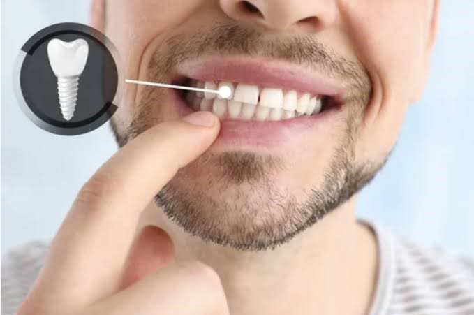 Los dientes podrían ver volver a crecer muy pronto